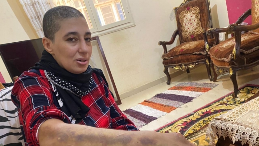شيماء ضحية تعذيب زوجها في الإسكندرية
