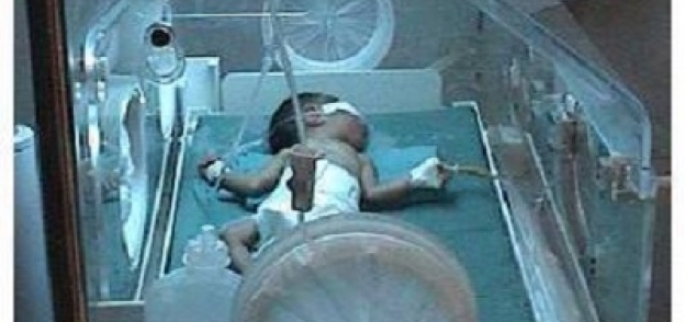 أحد الأطفال داخل الحضانة بمستشفى جامعة المنيا