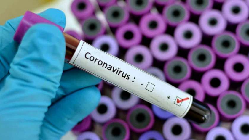 روسيا: نعمل على إنتاج لقاح ضد فيروس "كورونا الجديد"