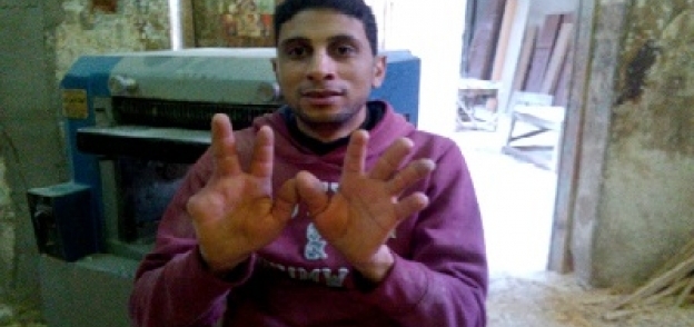 «محمد» يشكو سوء حالته الاقتصادية بسبب فقده أصبعين وعقلتين