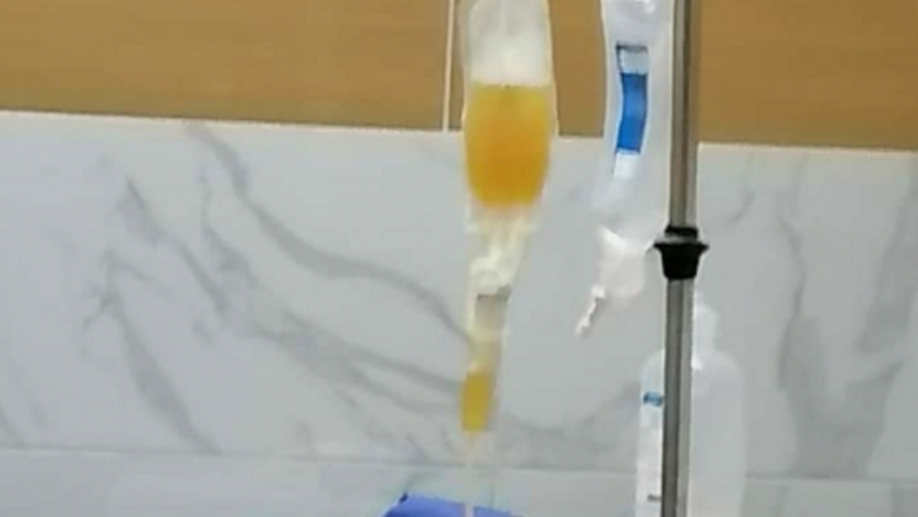 مستشفى التأمين الصحي بكفر الشيخ يجرى فصل" بلازما" لمريضة كورونا