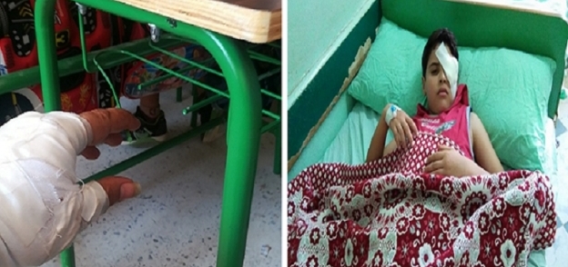 بالصور| أسلاك حديدية بالمقاعد في مدرسة شهدت "فقء عين تلميذ" في العاشر