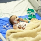 طفل عقب إجراء جراحة قلب مفتوح له بمستشفى كفر الشيخ الجامعى