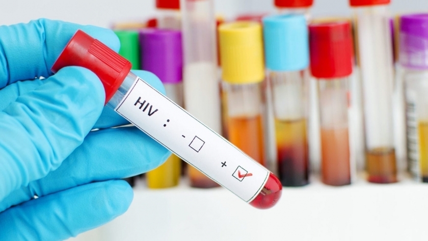 عينة تحليل لفيروس الإيدز- صورة أرشيفية