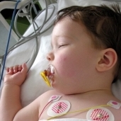 حماية الاطفال من فيروس الجهاز التنفسي الخلوي