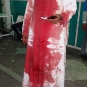 أثار الدم على ملابس المواطن الذي قام بنقل الضحية إلي مستشفى الإسماعيلية العام