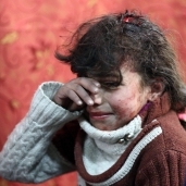 طفلة سورية نجت من نيران القصف