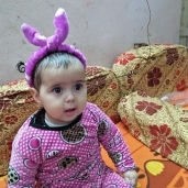 الطفلة خلود محمود التى تحتاج جراحات