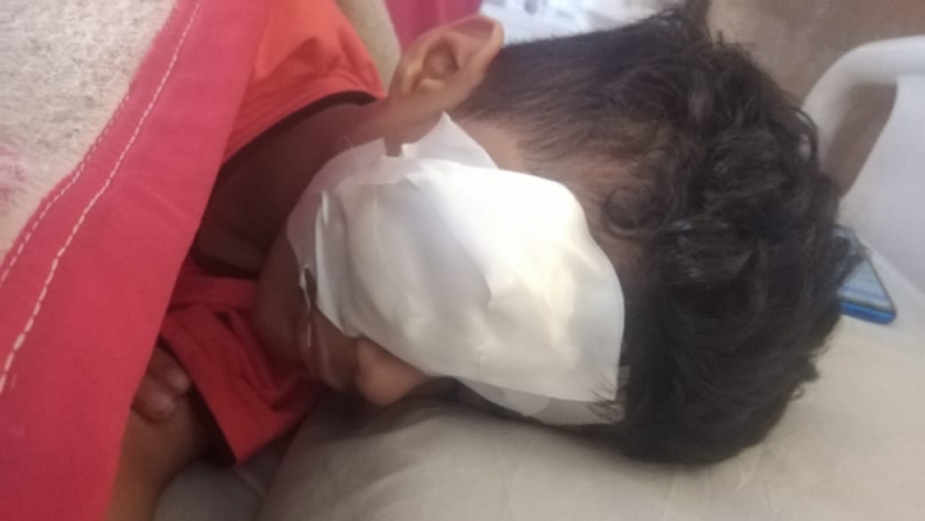 الطفل أحمد بعد انفجار عينه بسبب صاروخ ألعاب نارية بالفيوم