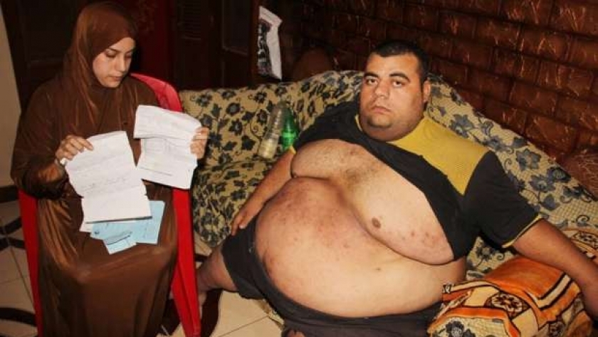 محمود سمير، مريض السمنة المفرضة الذي عُولج على نفقة الدولة