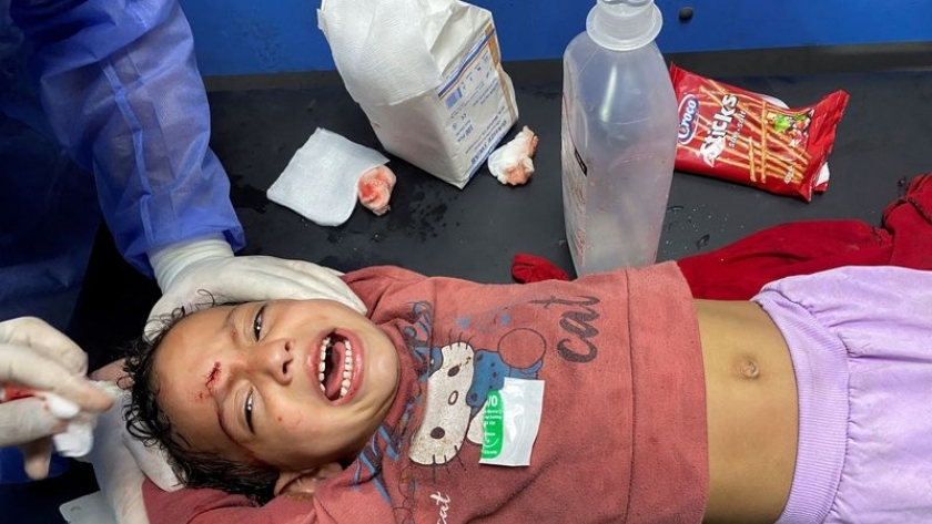 أطفال غزة المصابين ضحايا العدوان