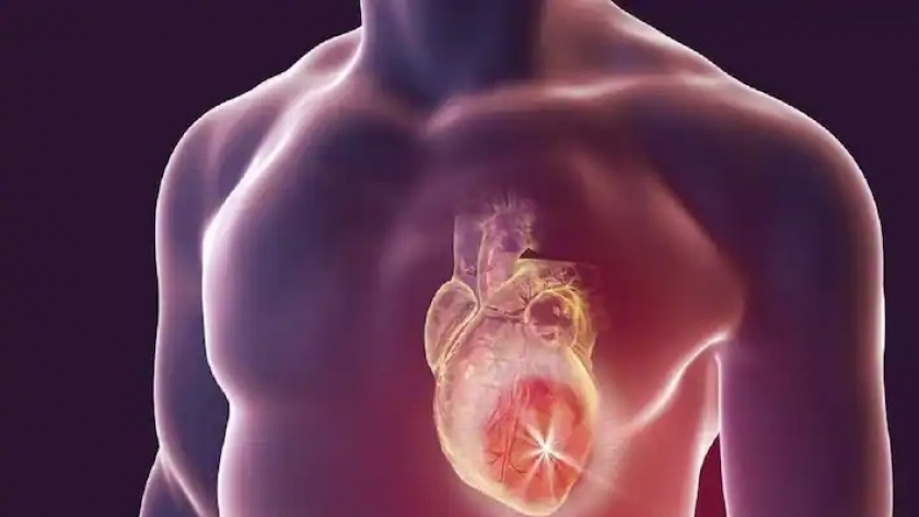 التهاب عضلة القلب- صورة أرشيفية