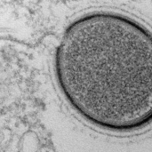 إكتشاف فيروس عملاق خامد عمره 30 الف سنه والعلماء يحاولون إيحاءه مجددا
