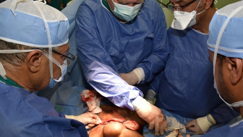 عملية فصل التؤام الملتصق بمستشفيات جامعة عين شمس