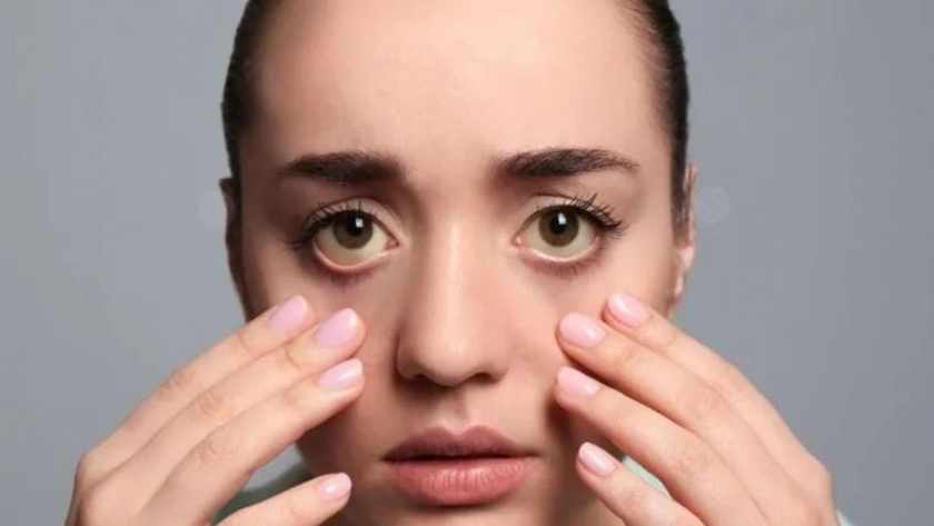علامات في العين تكشف الإصابة بمرض خطير