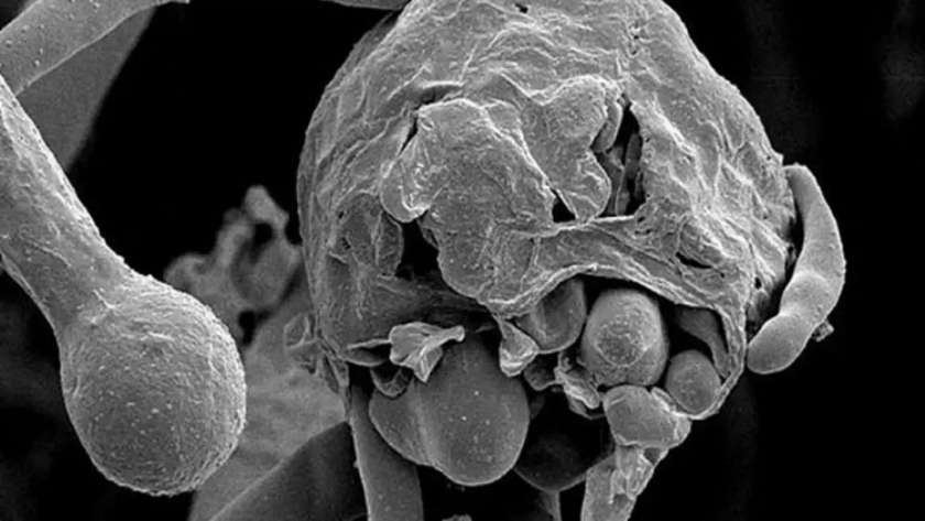 مرض الفطر الأسود ـ صورة أرشيفية