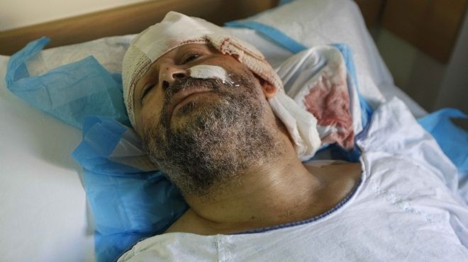 مسؤول طبي ينفي وجود إصابات بأسلحة كيمائية في طرابلس بشمال لبنان