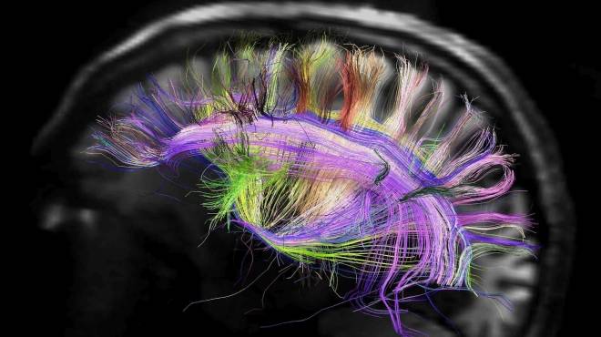  بحث جديد: الدماغ البشري يقوم بتلوين الأشياء 