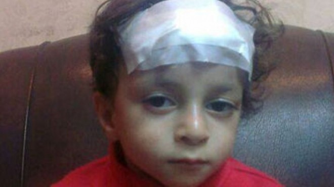 إصابة طفل في اشتباكات بالحجارة بين أنصار المعزول والأهالي في شبرا الخيمة