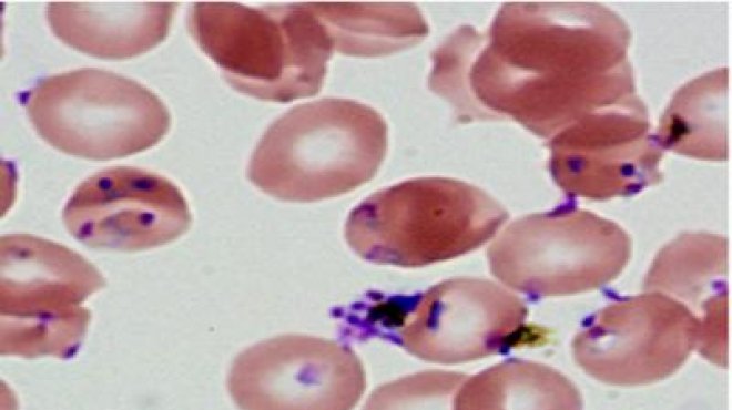 دراسة أمريكية تطور لقاحاً ضد الملاريا بإستخدام مجموعة مختلفة من البروتينات 