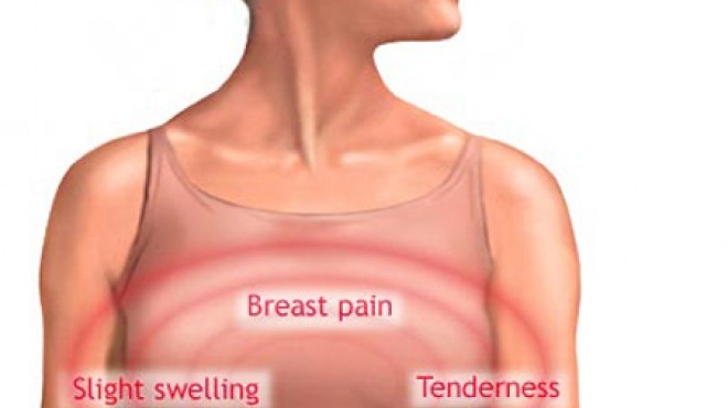  تورم الغدد الليمفاوية تحت الإبط ضمن أعراض الإصابة بسرطان الثدي