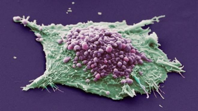 طريقة جديدة لتحليل كيفية موت الخلايا السرطانية