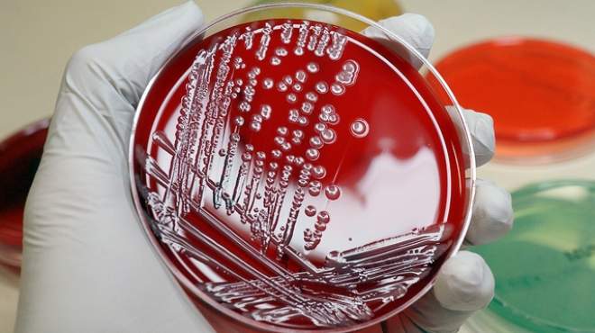 القومي للبحوث يتوصل لمشتقات البولي أميدات لمقاومة الميكروبات 