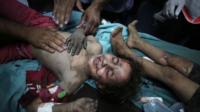 إسرائيل تحرق.. و«غزة» صامدة