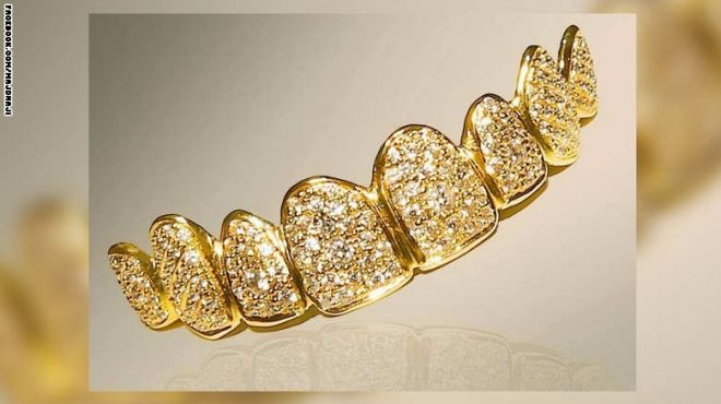 عيادة في دبي تصمم أغلى تقويم أسنان في العالم من الذهب والألماس