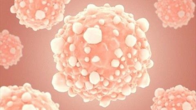 دراسة: حقن الجسد بالملح يقتل الخلايا السرطانية