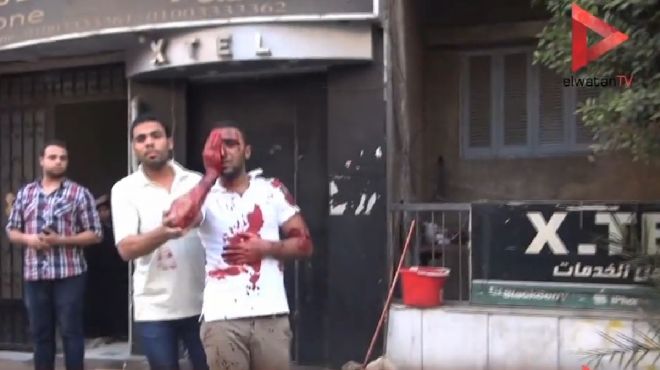 بالفيديو| إصابة أحد أعضاء حركة 