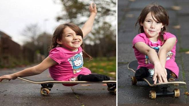 طفلة بريطانية مبتورة الساقين تحترف رياضة التزلج