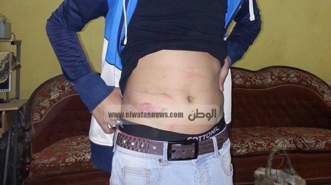بالصور| الشرطة تعذب طالب ثانوي داخل قسم الدقي لرفضه الإهانة