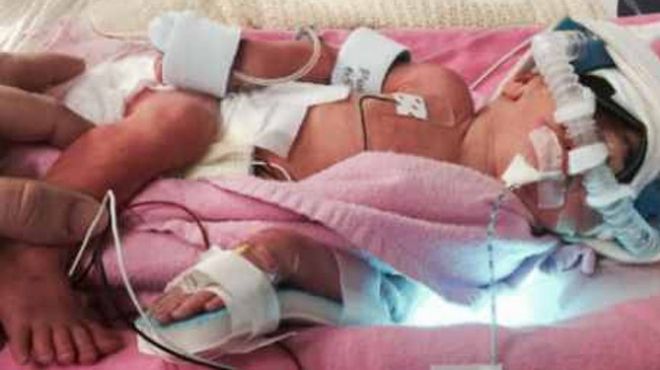 احتجاز مولود أمريكي في مستشفى بالصين لعدم سداد نفقات الولادة