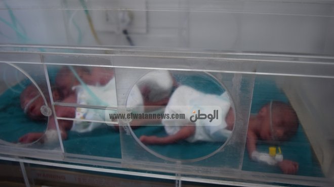 بالصور| ولادة 3 توائم بمستشفى جامعة المنصورة