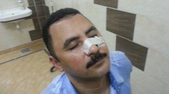 ضابط شرطة يعتدي على محام ويصيبه بكوب فارغ بمحكمة في المنيا