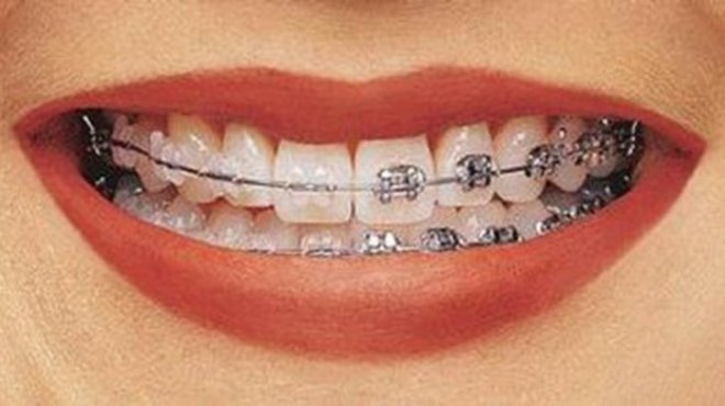  نقابة أطباء الأسنان بدمياط تحذر من التعامل مع مدعي المهنة 