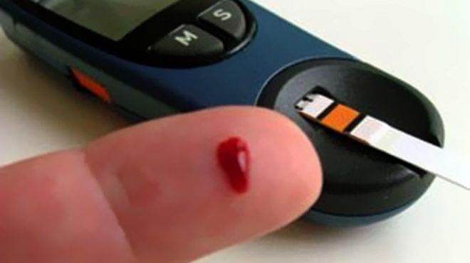 دراسة: خفض مستوى السكر في الدم يقي الإصابة بمرض السكر 