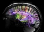  بحث جديد: الدماغ البشري يقوم بتلوين الأشياء 