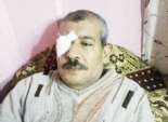 «عبدالهادى» فقد بصره بسبب طبيب ملتحٍ و«سيرة مرسى»