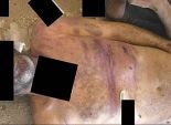 بالصور| محققون بجرائم الحرب: عمليات قتل وتعذيب تظهر على جثث سورية