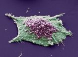 طريقة جديدة لتحليل كيفية موت الخلايا السرطانية