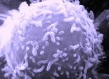 بكتيريا مغناطيسية تساعد في تشخيص سرطان المعدة 