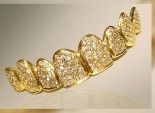 عيادة في دبي تصمم أغلى تقويم أسنان في العالم من الذهب والألماس
