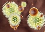 «دوس»: بدء العلاج بـ«عقار فيروس سى» الجديد منتصف أكتوبر