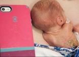 بالفيديو| أصغر مولودة في العالم أقل حجما من هاتف 