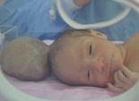 إجراء جراحة ناجحة بالمخ لرضيع بمستشفى بني سويف الجامعي