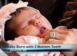 سيدة أمريكية تلد طفلة بأسنان أمامية