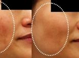 6 نصائح للحافظ على بشرتك أثناء فترة الحمل