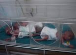 بالصور| ولادة 3 توائم بمستشفى جامعة المنصورة